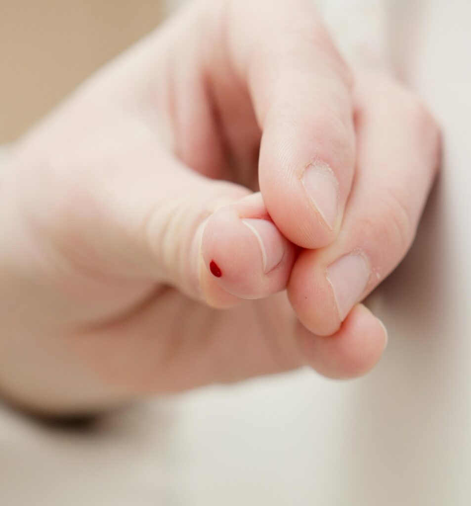 finger stick blood tests